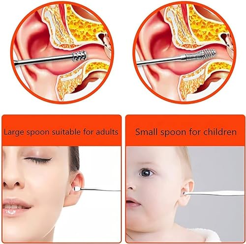 Image of Khedu Fab Ear Pick 6 Pc's with a Storage Box Earwax Removal Kit | Ear Cleansing Tool Set | Stainless Steel Spiral Ear Curette Ear Wax Remover Tool with Cleaning Brush (Pack of 1 kit)