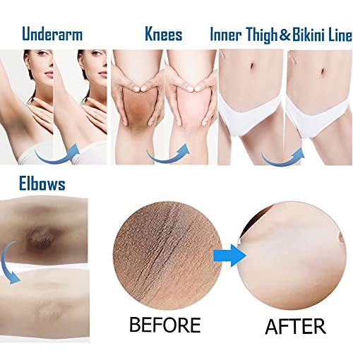 Ceavo Skin Lightening Cream For Dark Areas - Underarm, Knees, Elbows, Bikini Line - Permanent Whitening & Dark Spot Remover, 1 Oz, Usa Designed #TOP1