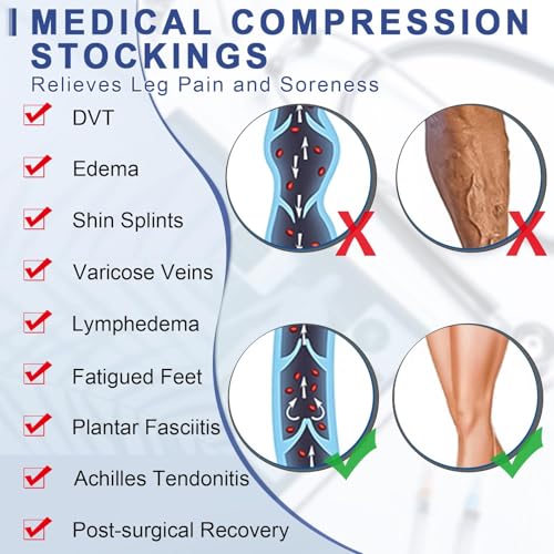 Image of Beister Thigh High Compression Stockings with Silicone Band for Women & Men, 20-30 mmHg Footless Graduated Support Sleeves, Medical Compression Hoses for Varicose Veins, Edema, Flight