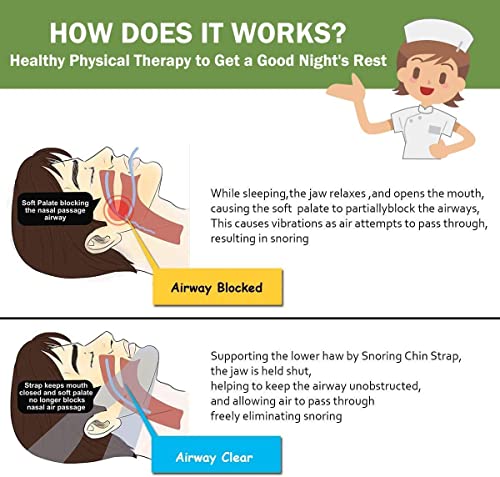 2023 Upgrade Anti Snoring Devices,Chin Straps Devicesanti Snoring Devices Anti Snoring Chin Strap For Men Women,Chin Straps Sleep Aids For Snoring Mouth Breather #TOP5