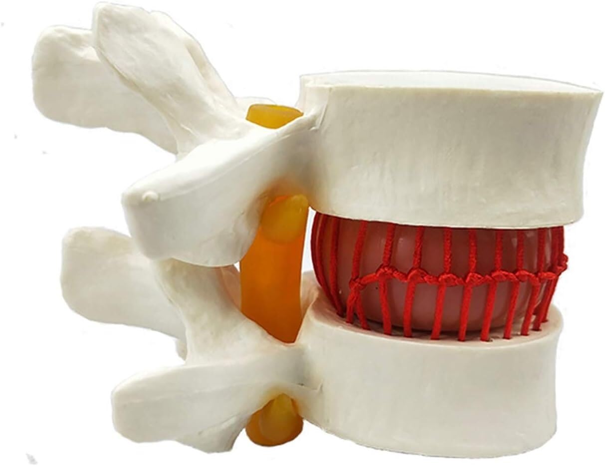 Modello di Dimostrazione del Disco Lombare Umano Modello della Colonna Sonora del Dorso Giallo Umano Colonna Lombare Anatomica Colonna Vertebrale Lombare