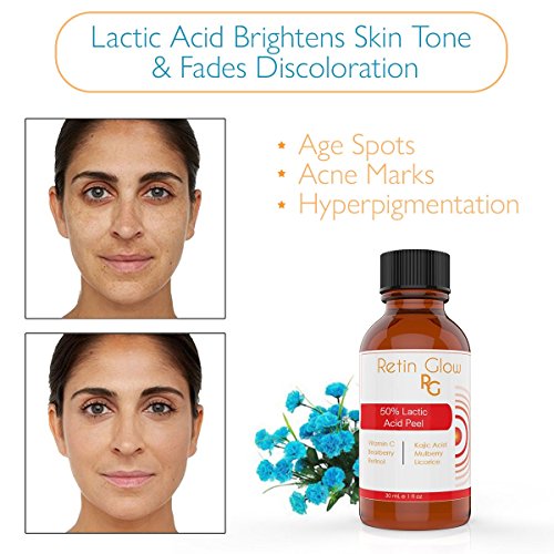 Lactic Acid 80% Gel Peel Including After Peel Neutralizer Facial Peel Contains Retinol Vitamin C Kojic Acid Licorice Bearberry Tea Mulberry. Perfect Acne Treatment Fade Acne Scars Diminish Wrinkles - Thumbnail 5
