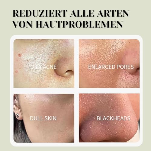 Grüner Tea Masken, Green Mask Stick, Tiefenreinigung Gesichtsmaske Hautpflege, 2 Stück Mask Stick Blackhead Remover Holzkohle Gesichtsmasken, Kontrolle Öl, Verfeinerung Poren – Bild 3