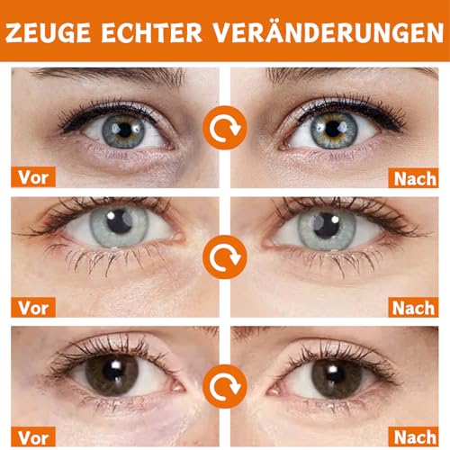 60 Stück Vitamin C Augenpads, VC Augenpads gegen Augenringe & Tränensäcke, Augenringe Entfernen, Anti Aging Eye Pads mit Kollagen & Hyaluron, Eye Mask für Männer & Frauen, Feuchtigkeit Augenpflege