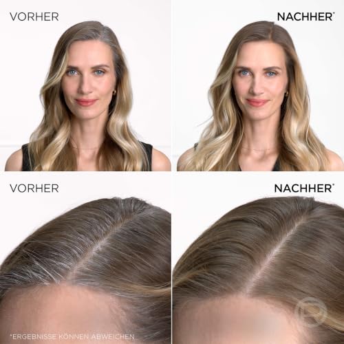 L'Oréal Paris Ansatz-Kaschierspray für stufenlose und natürliche Übergänge, Kaschiert Ansätze bis zur nächsten Haarwäsche, Magic Retouch… – Ansicht 4