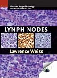 Lymph Nodes (Cambridge Illustrated Surgical Pathology)
