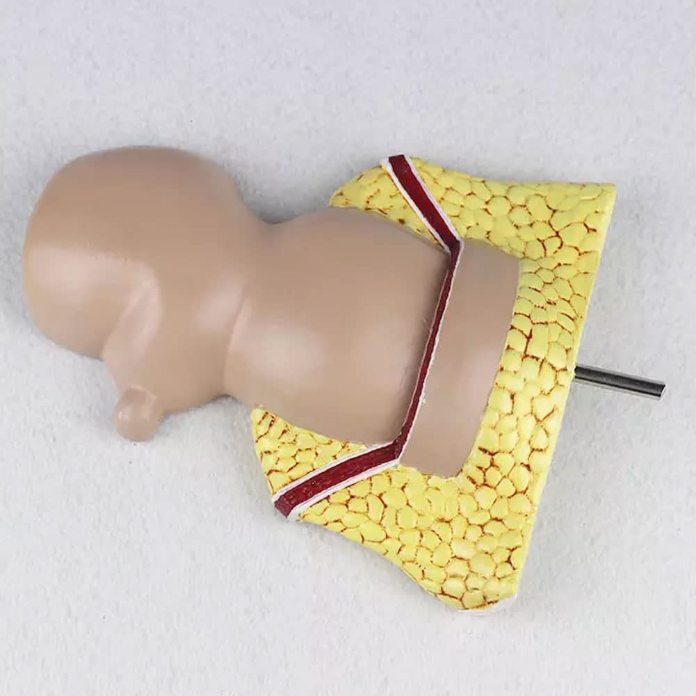 Model Odbytnicy Człowieka Odbytnicy Model Powiększenia Zmian Patologicznych Model Rozszerzenia Układu Trawienia Anatomia-Modele Medyczne Materiały Edukacyjne