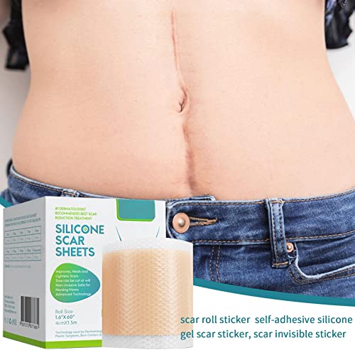 Tiras de Remoção de Cicatrizes | Rolo de fita adesiva autoadesiva - Folhas de silicone para remoção