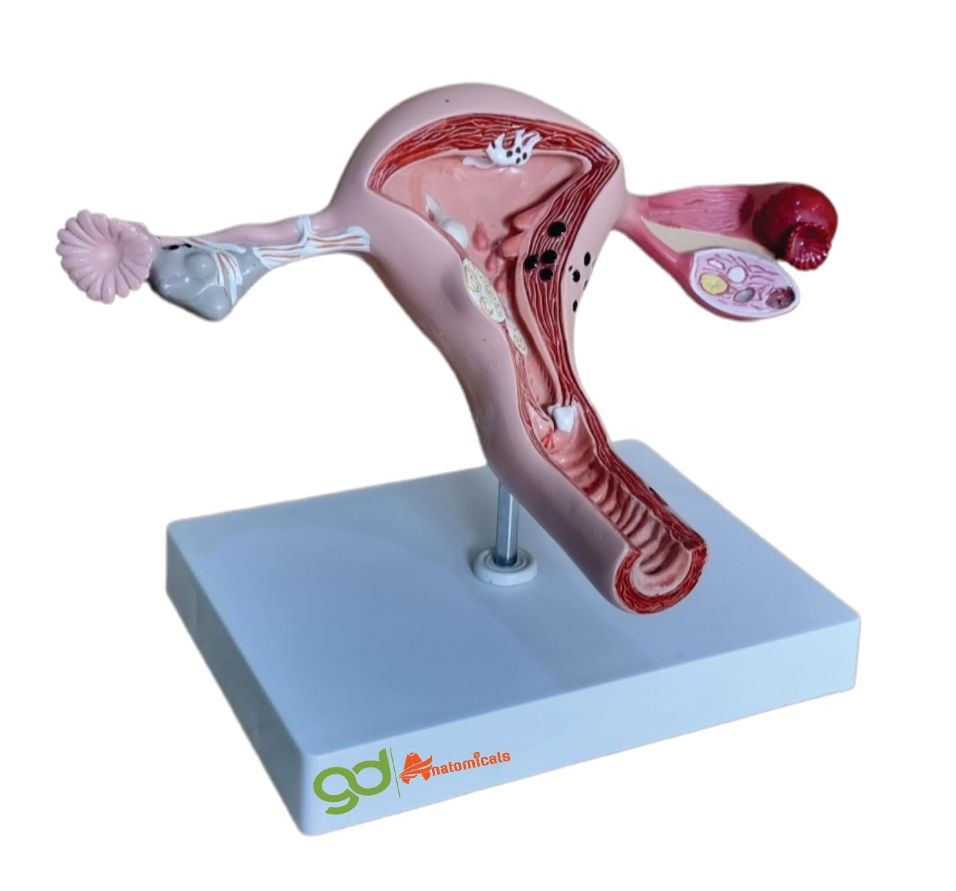 GD ANATOMICALS ® Pathological Uterus Anatomical Model (B0CPXZPBXL) Amazon Price History, Amazon Price Tracker