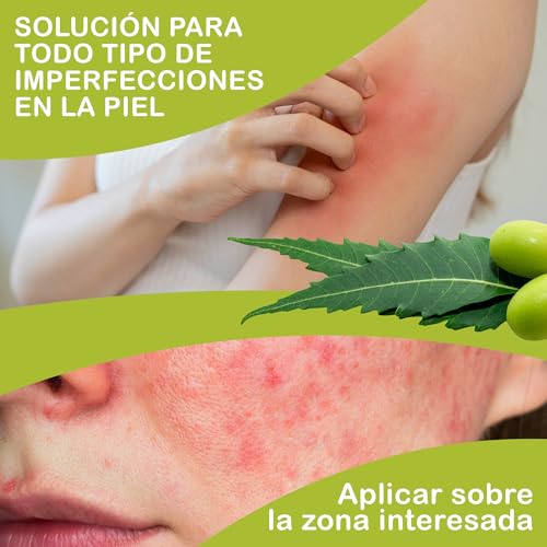 +300 Plagas Plantas, Aceite de Neem, Huerto Saludable, Agricultura Eccologica, Anti Pulgones, Cochinillas, Piel y Cabello, Previene Infecciones, Cuidado de Mascotas, Anti Mosquitos, Repelente 500 ml - imagen 7