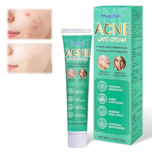 Crema Para El Acné, Acnes Cream, Crema Antiacne, 20g, Pomada facial antiacné, Cream para el cuidado facial, Humectación Duradera,Sin Resequedad,Eliminar El Acné Para Pieles Propensas A Las Espinillas