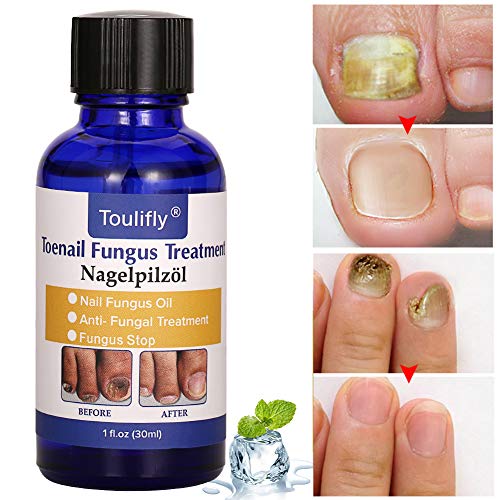 Nagelpflege und Behandlung, Nagelpflege für gesunde Fuà und Hand, Nagelpflegeöl,Nagelpflege pflegend – Bild 5