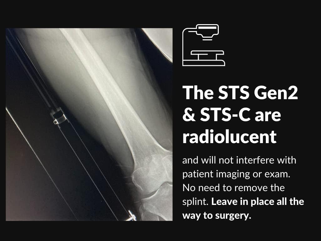 Rescue Essentials Slishman Traction Splint (STS) - Gen 2
