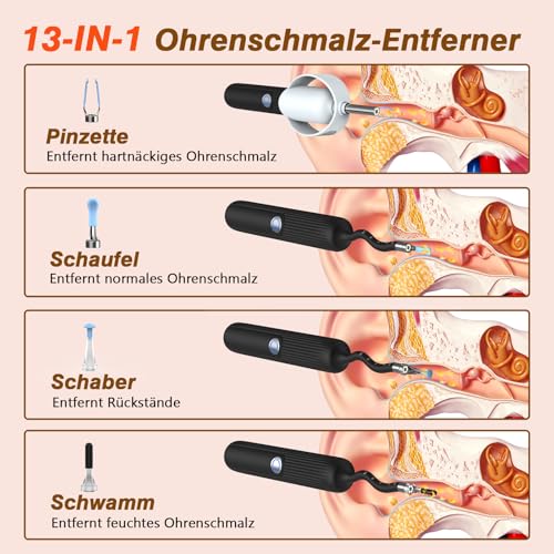 Ohrenschmalz Entferner Otoskop, AZHE Flexibel 1080P Wi-Fi Ohrreiniger, Wasserdicht Ohrenreiniger, 3.1mm Ohrreiniger mit Pinzette, für Erwachsene, Kinder und Haustier, Schwarz