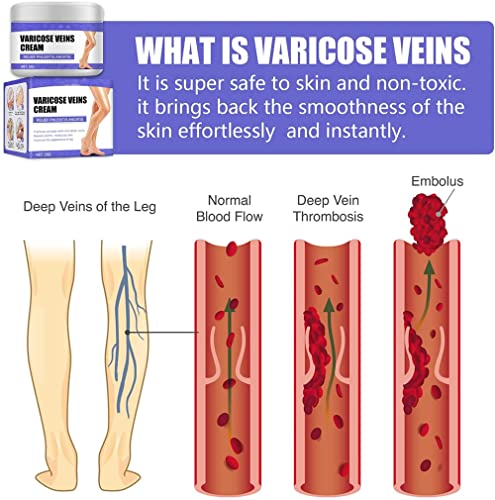 Vein Care Fading Cream, Varicose Veins Cream