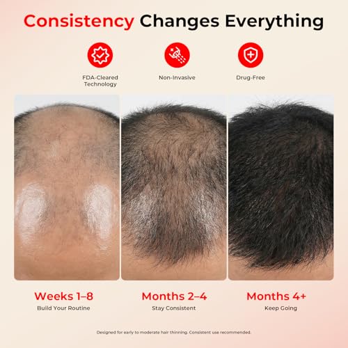Image of CAYAMA Red Light Hair Growth Cap for Men & Women, 528 Total Light Emitters | Full-scalp coverage with adjustable fit, 10-30 min remote sessions, adapter or compatible power bank support