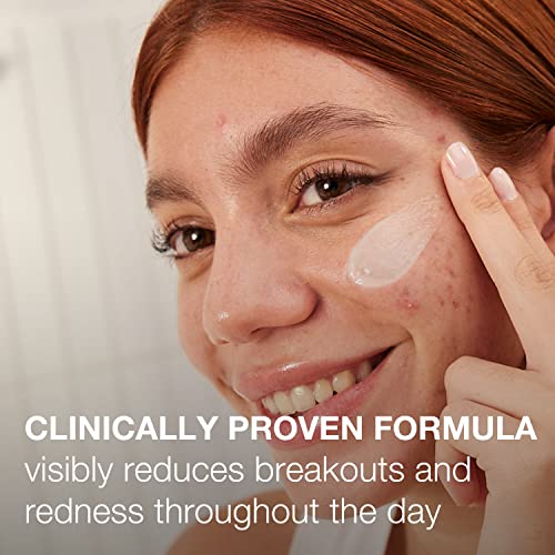 Neutrogena Stubborn Acne Am Face Treatment With 2.5% Micronized Benzoyl Peroxide Acne Medicine, Oil-Free Daily Facial Treatment To Reduce Size & Redness Of Breakouts, Paraben-Free, 2 Oz #TOP2