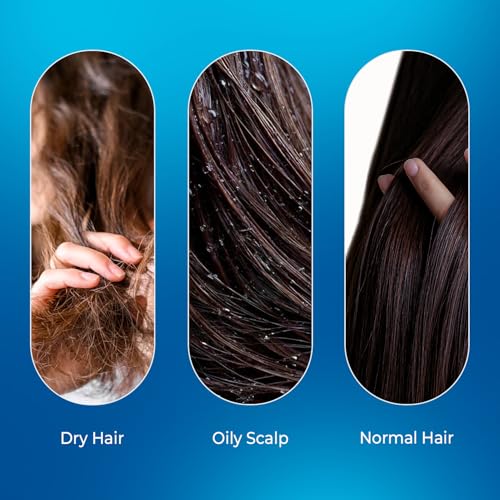 Image of VINR Hair Growth Serum for Scalp Concentrate 5-Actives Redensyl, Anagain, Baicapil, Procapil & Caffeine with Grape Seed Extract|Advanced Hair Fall Control & Boosts New Growth| Hair Regrowth Serum for Scalp| For Men & Women |30 ml (Pack of 2)