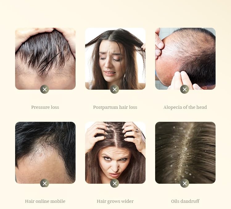 Miniatura 4 de 2 cajas de champú para el cabello con extracto de planta de jengibre, champú de jengibre para el crecimiento del cabello, control de aceite, cuidado