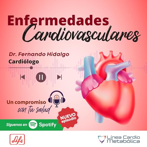 Enfermedades Cardiovasculares