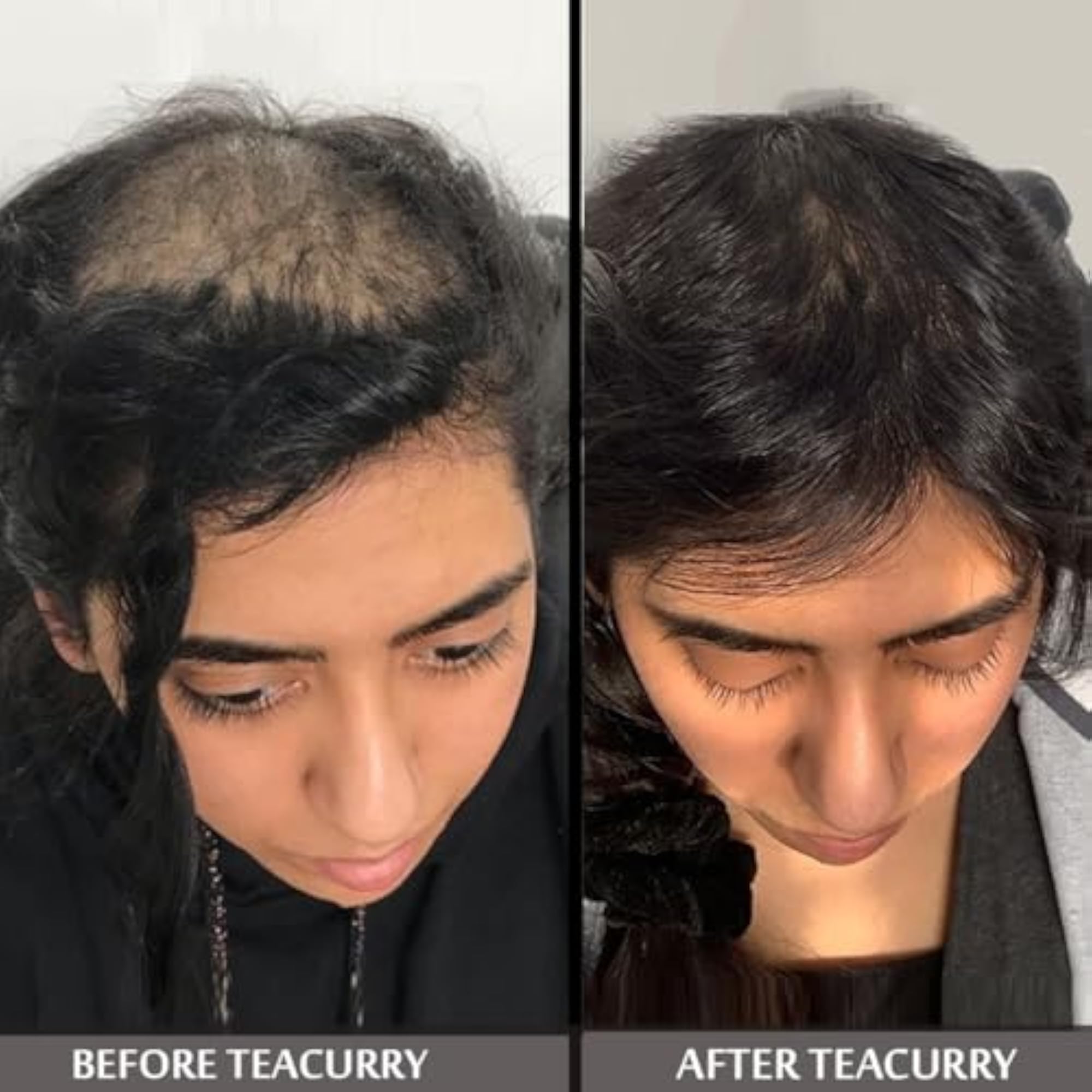 Tea for Baldness, 30 Tea Bags, 1 Month Pack