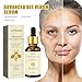 Advanced Bee Venom Serum, Anti-Aging Facial Serum, Face Serum to Help Refine Fine Lines & Wrinkles, Hydrating facial essence