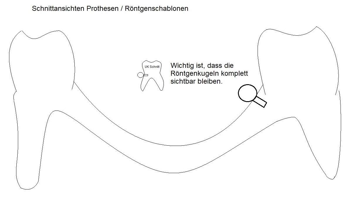 Röntgenkugeln aus bariumsulfathaltigem Kunststoff für CT, DVT (7)