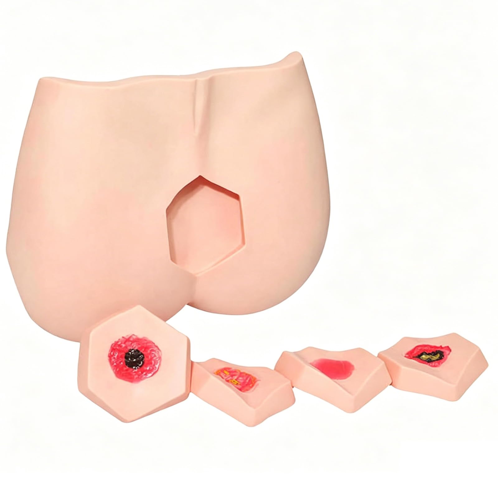 WHOOLEFUN Decubitus Ulcer Training Model, 4 Stages Of Bedsores Pressure Sore Model, Pressure Injury Model, Simulates Adult Buttocks, for Nursing Teaching, Practical Simulation