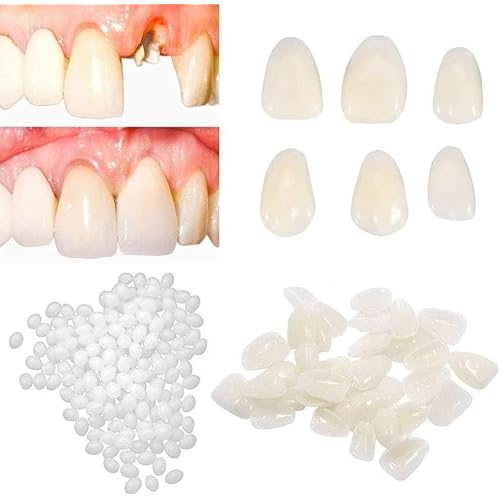 Fake Tooth Repair kits for Filling The Missing Broken Tooth and Gaps-Moldable and False Teeth Thermal Beads Replacement Kits