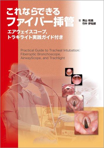 無料電子書籍 おすすめ これならできるファイバー挿管 -エアウェイスコープ,トラキライト実践 バイ