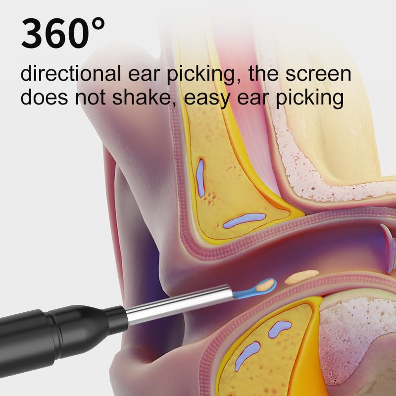 Image of CPENSUS Ear wax cleaner tool kit with 1080P camera WIFI & LED Light Rechargeable portable Baby Children adults gift gadget for IOS & Android