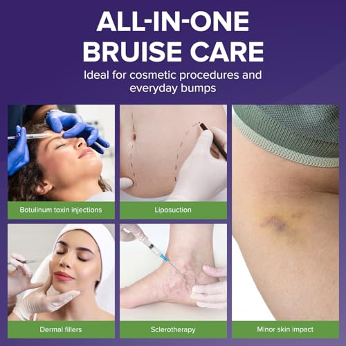 Image of Biocorneum Bruise Cream with Arnica & Vitamin K, Professional-Grade, 1 oz