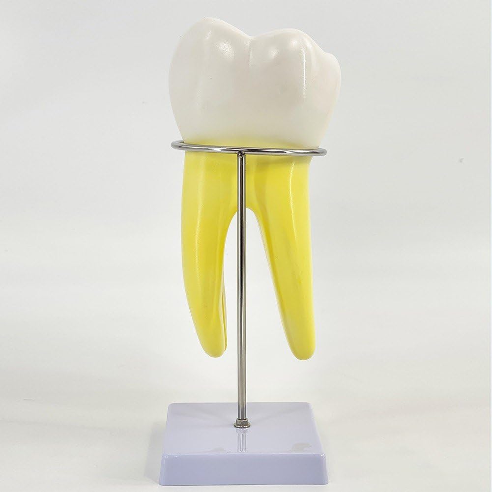 Modèle D'anatomie Modèle De Dents Molaires pour L'étude des Maladies Modèle De Dents Modèle De Dent Humaine