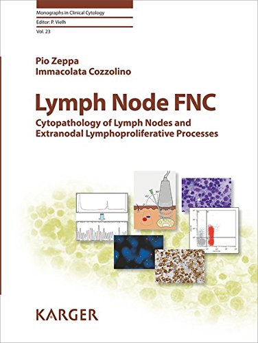 Lymph Node FNC: Cytopathology of Lymph Nodes and Extranodal Lymphoproliferative Processes (Monographs in Clinical Cytology, Vol. 23)
