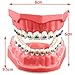 Dental Orthodontic Model Teeth Treatment Model with Metal Bracket Archs Tubes Ligature Ties for Teaching Studying Standard Size