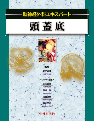 脳神経外科エキスパート頭蓋底 |本 | 通販 | Amazon