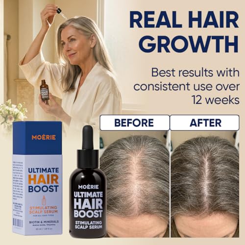 MOERIE Ultimate Hair Growth Serum 50ml — Caffeine + Biotin Scalp Serum — view 4