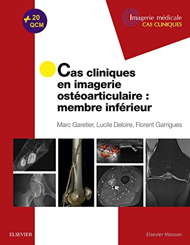 Cas cliniques en imagerie ostéoarticulaire : membre inférieur: Membre Inferieur (Imagerie médicale: cas cliniques) Cas cliniques en imagerie ostéoarticulaire : membre inférieur: Membre Inferieur (Imagerie médicale: cas cliniques)