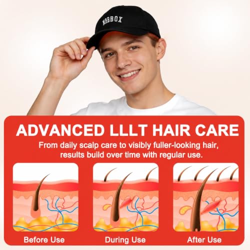 Image of Red Light Hair Growth Cap - FDA Cleared Red Light Therapy for Hair Growth for Men & Women