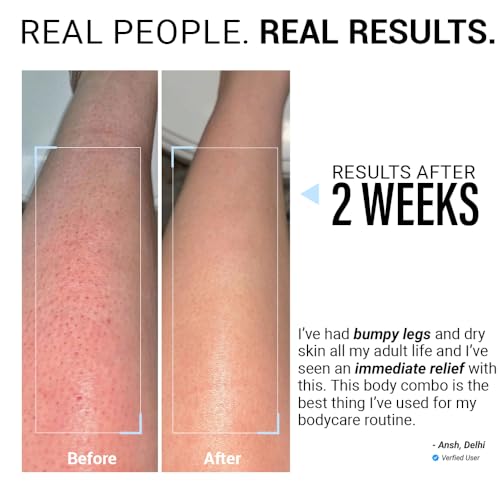 Image of Sereko 48H Skin Relief Body Wash and Lotion Travel Combo | Urea Treatment for Strawberry Legs, Detan, Brightening |Gentle Exfoliating, AHA & BHA Free for Very Dry, Flaky Skin 60ml