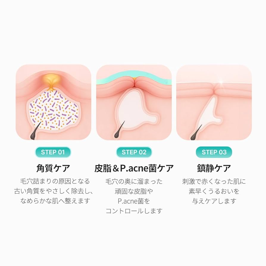 Amazon | メディキューブ アゼライン酸16BBカーミングセラム 油