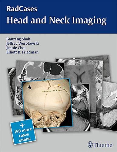 Radcases Head and Neck Imaging
