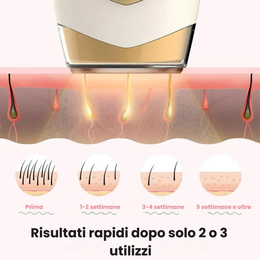 Lumina Lumisilk Depiladora Laser Ipl (Blanco)
