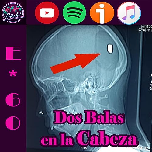 『E*60 | Dos Balas en la Cabeza』のカバーアート