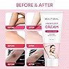 Dark-Spot-Corrector-Cream-Armpit-KneesElbows-Private-Areas-Instant-Result-Body Dark Spot Corrector Cream, Armpit, Knees,Elbows, Private Areas, Instant Result (Body)