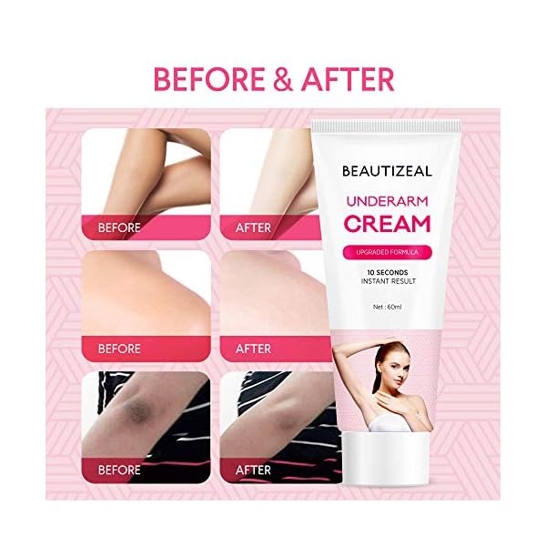 Dark-Spot-Corrector-Cream-Armpit-KneesElbows-Private-Areas-Instant-Result-Body Dark Spot Corrector Cream, Armpit, Knees,Elbows, Private Areas, Instant Result (Body)