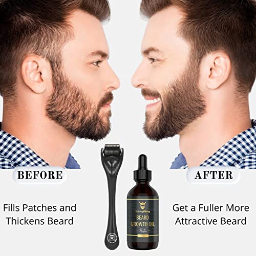 Striking Viking Beard Growth Kit – Beard Roller For Hair Growth For Men - Biotin Beard Growth Oil - Beard Roller Beard Kit For Thickening And Conditioning Beards (Sandalwood) #TOP1