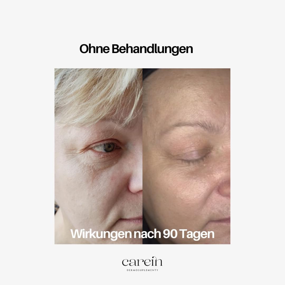 Hydrated Skin Kapseln - Hautbarriere Stärkung mit Hyaluronsäure, Ceramiden & Astaxanthin - 90 Kapseln vegan - Trockene Haut Supplement - Carein