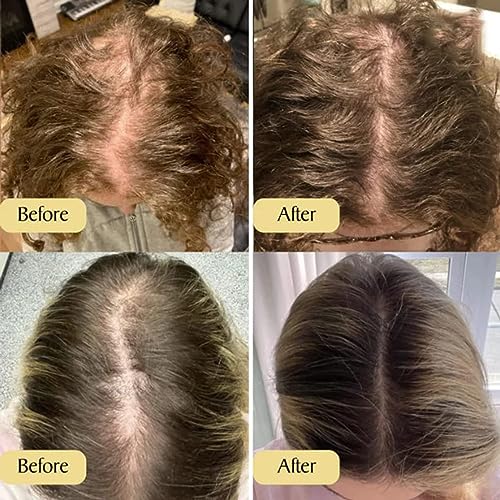 Houdini Natural Vegan Hair Growth Oil Rosemary Essential Oils Pure Natural Hair Density Oil Reduce H