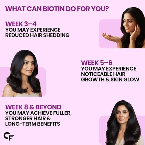 Image of Carbamide Forte Biotin Tablets for Hair Growth | Biotin Supplement 10000 mcg | Hair Supplements for Women & Men | 90 Hair Growth Tablets - 3 Months Supply